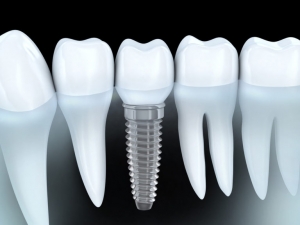 Advanced Dental Care of Englewood